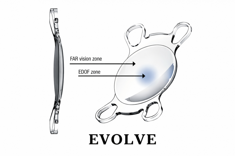 EVOLVE(エボルブ)の見え方の特徴