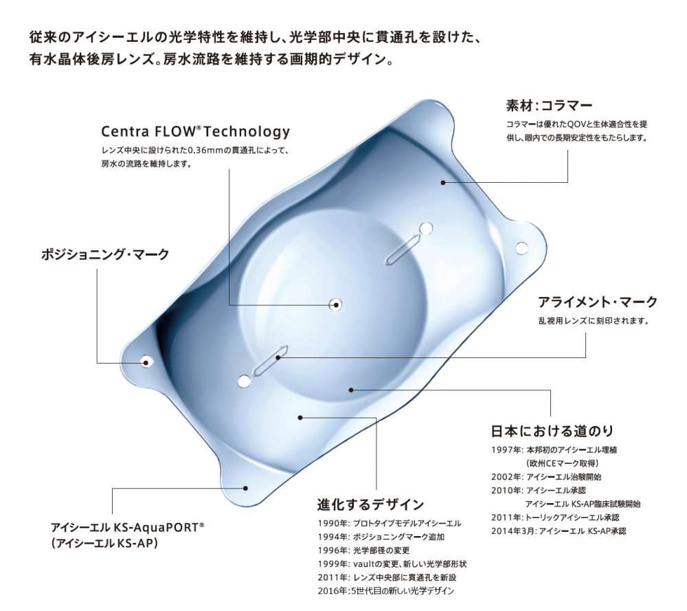 ICL(眼内コンタクト)とは?|東京で注目される理由